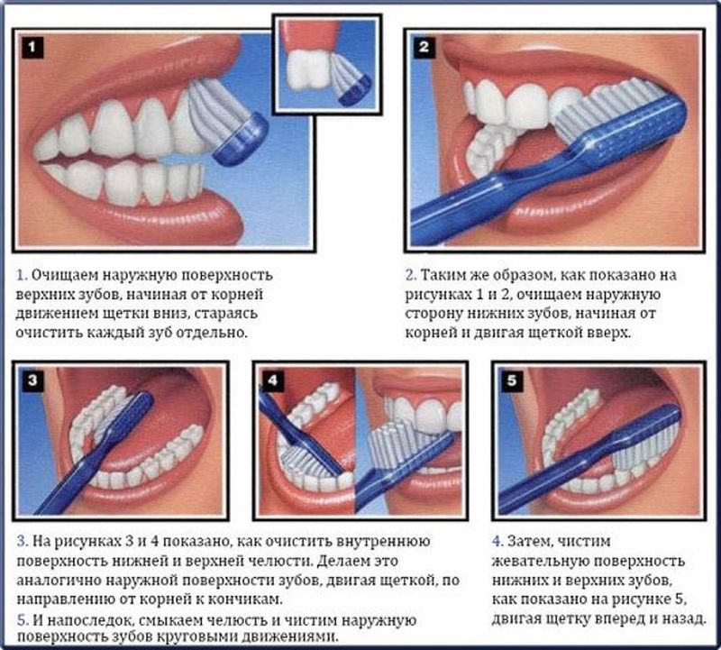Как отбелить зубы